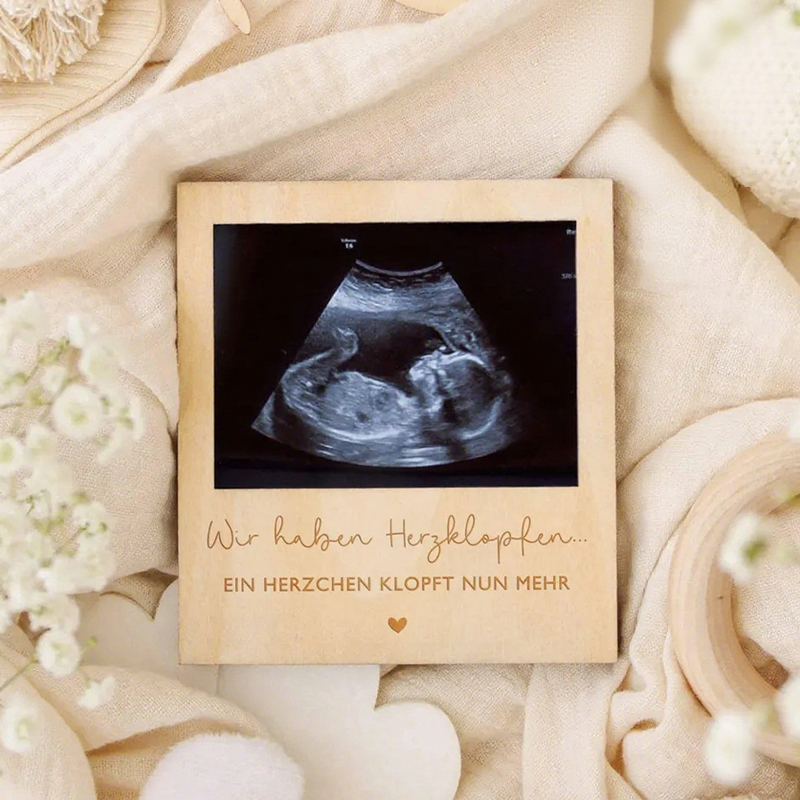 Ultrasound Pregnancy Announcem - Photo Booth Frame review and price